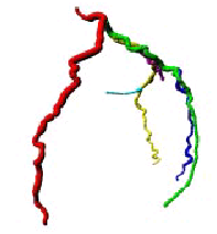 3D graph resulting of the reconstruction using GCoro 3D graph resulting of the reconstruction using GCoro